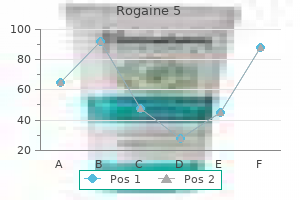 generic 60ml rogaine 5 visa