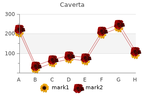 buy 50mg caverta visa