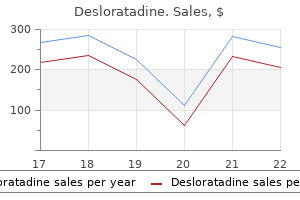 cheap 5 mg desloratadine otc
