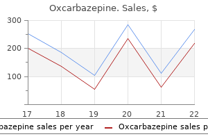 buy 300 mg oxcarbazepine fast delivery