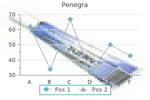 purchase penegra 50mg on-line